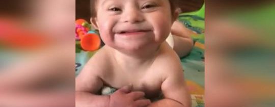 Bebê adotada com síndrome de Down sorri para sua nova mãe, e se torna viral