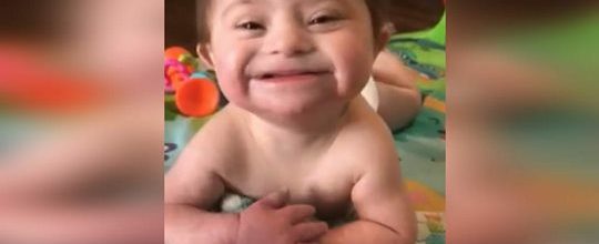 Bebê adotada com síndrome de Down sorri para sua nova mãe, e se torna viral