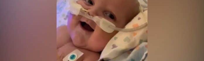Bebê que teve 2 operações de coração aberto sorri pela primeira vez