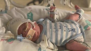 O ‘bebê guerreiro’ que nasceu com 765 gramas e sobreviveu ao coronavírus e à sepse