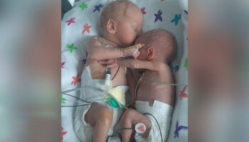 Gêmeos separados no nascimento ‘se abraçam e dão as mãos’