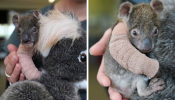 Bebê coala órfão de 5 meses recebe o mais adorável braço engessado após cair de uma árvore