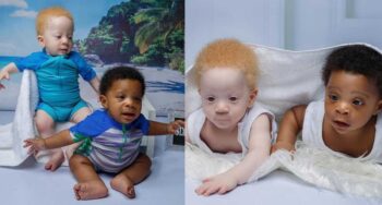 Nascem gêmeos com diferentes cor de pele e estão encantando a todos