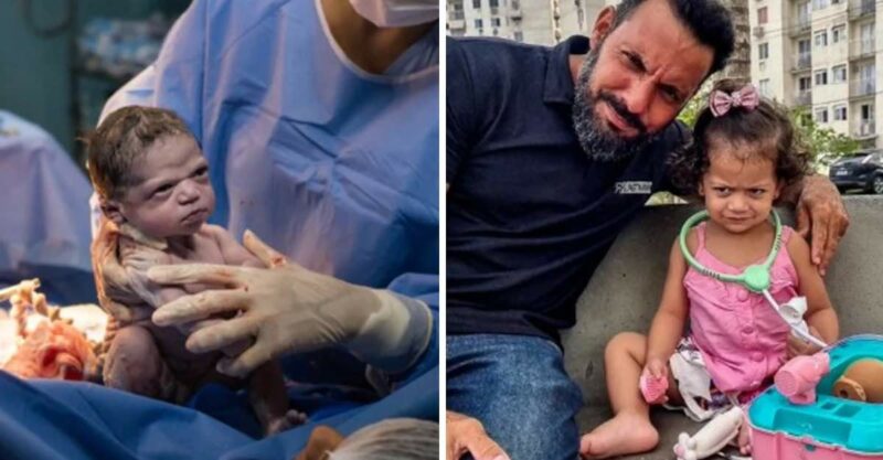 Fotógrafo que registrou bebê irritada ao nascer a reencontra 2 anos depois: “Ela sempre ri”