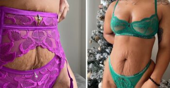 Marca de lingerie optou por usar “modelos reais” com estrias em sua nova coleção