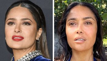 15 celebridades que não têm medo de mostrar seus rostos naturais sem filtros ou maquiagem