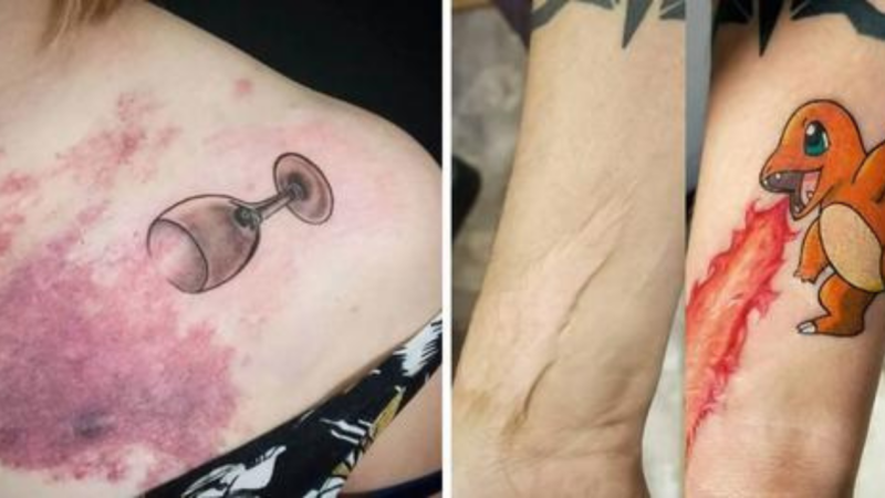 13 cicatrizes que se tornaram obras de arte através de tatuagens